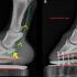 Podiatry: The Importance of Radiographs for Foot Balance